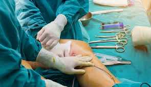 Orthopedic Surgery